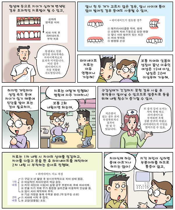 라미네이트