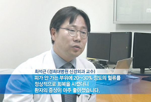 경희대학교병원 신경외과 최석근 교수