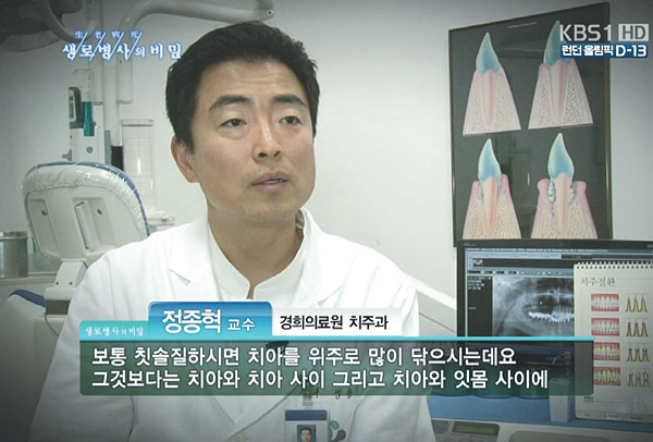 경희대학교치과병원 치주과 정종혁 교수