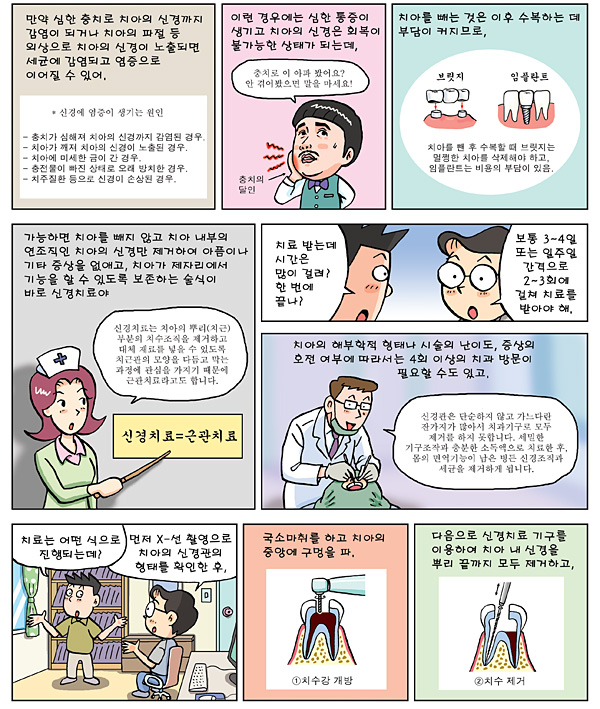 신경치료