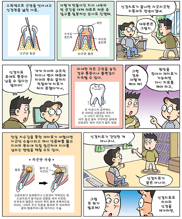 신경치료