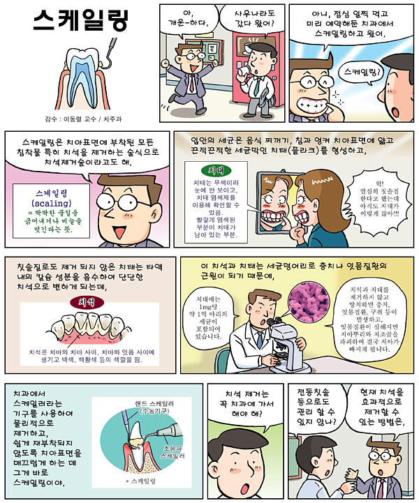 스케일링