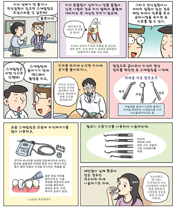 스케일링