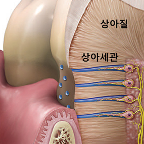 찬바람 불면 심해지는 시린이