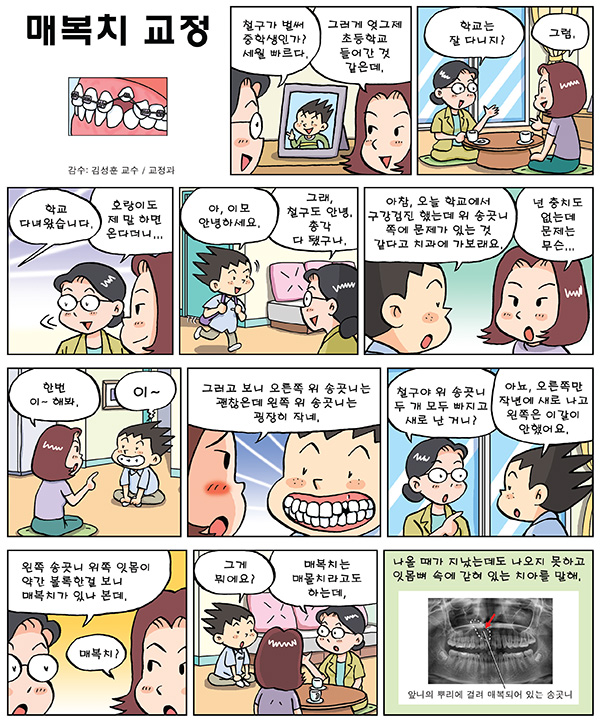 매복치 교정