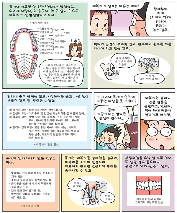 매복치 교정