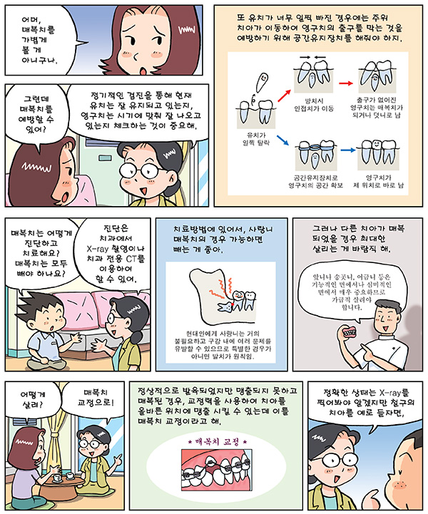 매복치 교정